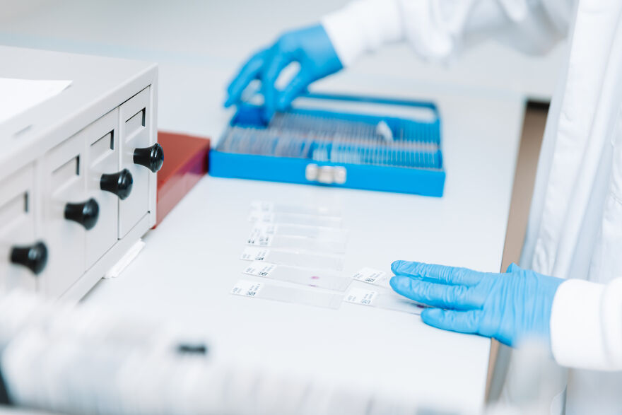Scientist wearing blue gloves preparing microscope slides in a lab, related to Alzheimer’s research and pharmaceuticals.